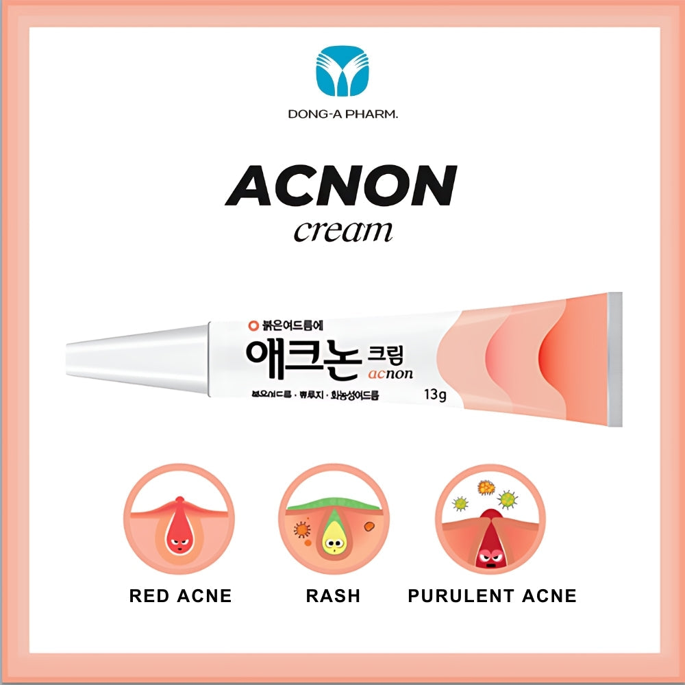 ACNON Cream | Acne Treatment | 13g